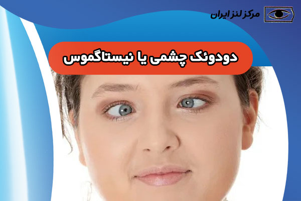 دو دوئک چشمی یا نیستاگموس ❗