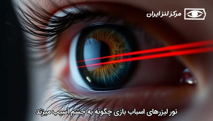 نور لیزرهای اسباب بازی چگونه به چشم آسیب می زند