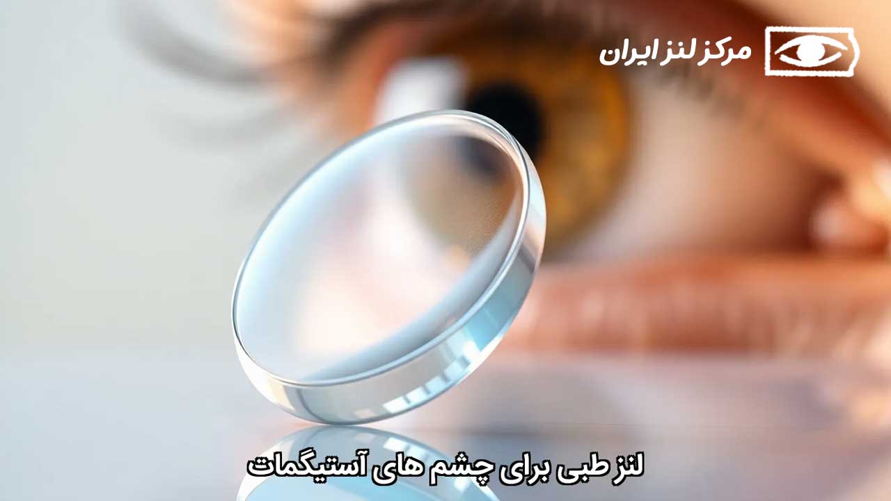 لنز طبی برای چشم های آستیگمات